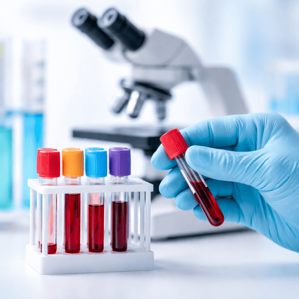 Lab Tests